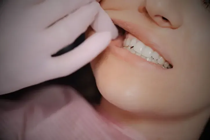 Endodoncia